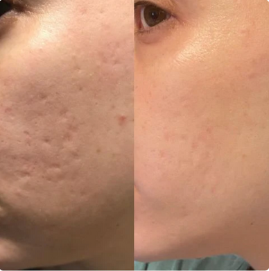 "Reveal Your Skin's True Beauty Again"